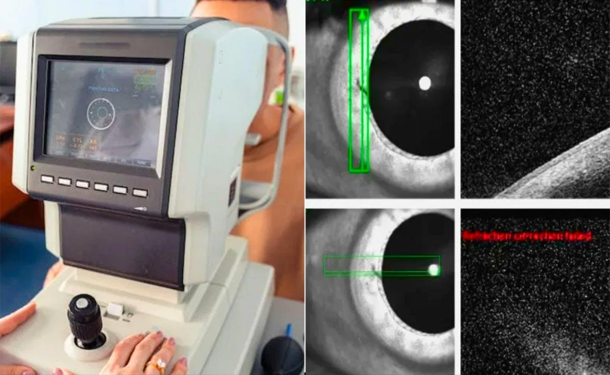 15 साल से आंख में फंसी थी एक खतरनाक चीज, देख डॉक्टर भी रह गए हक्के बक्के